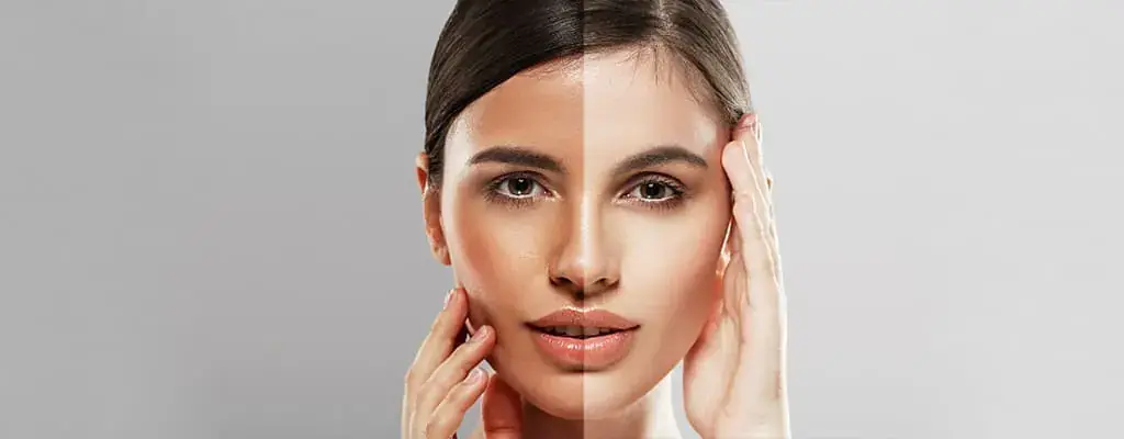 عوارض استفاده از قرص پیگمنتا