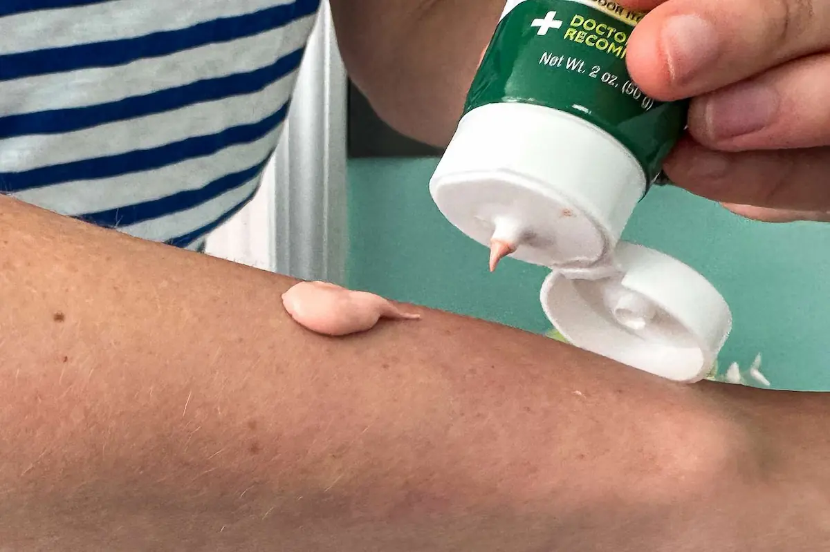 بهترین دارو برای درمان خارش بدن