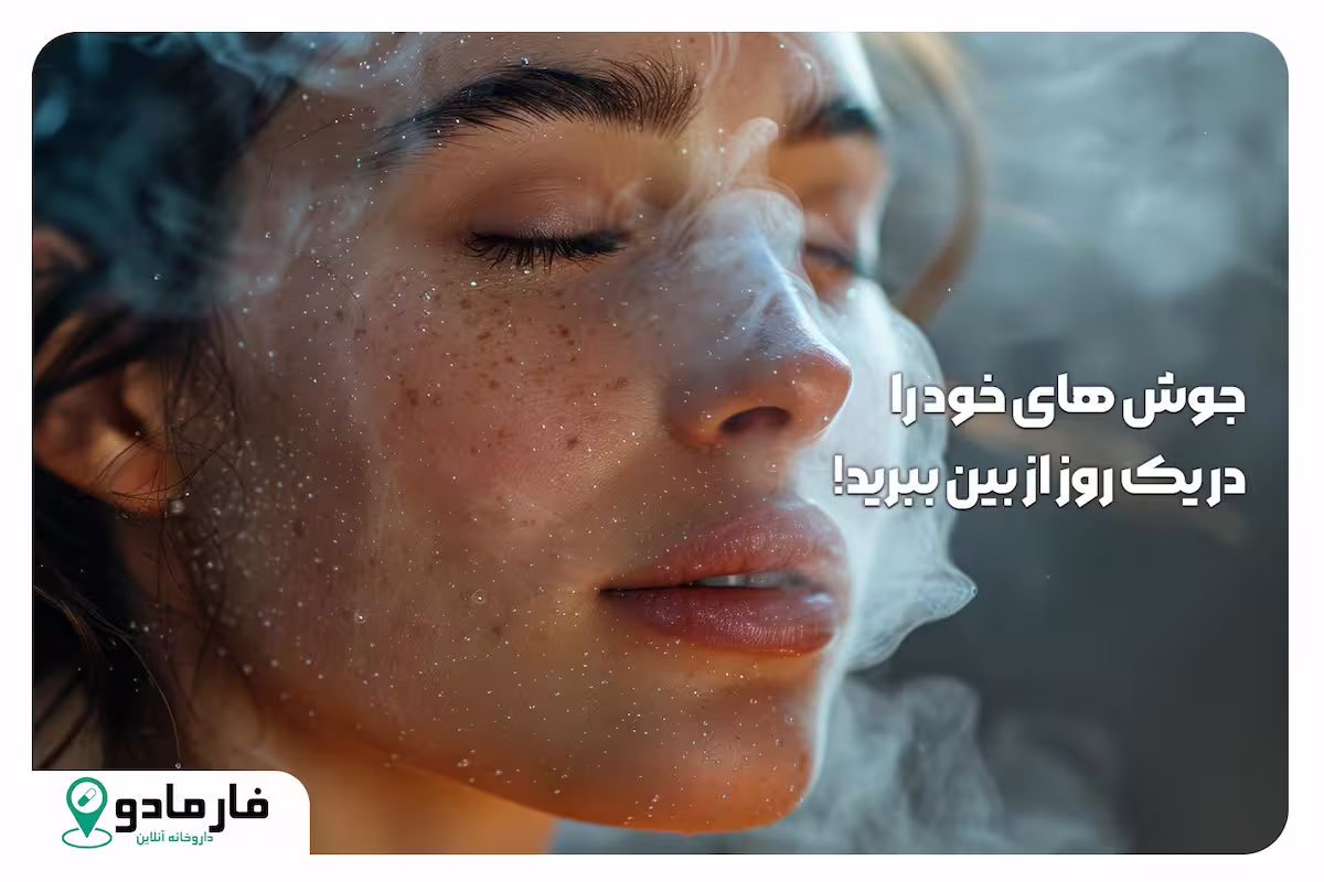 سریع ترین روش‌های از بین بردن جوش