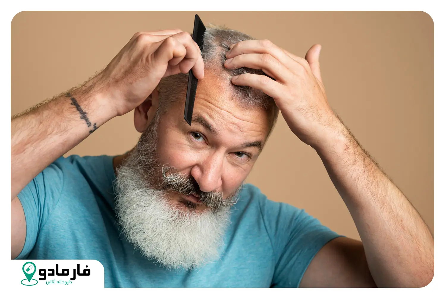 علت ریزش مو در آقایان چیست؟